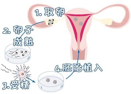 供卵代怀代生机构